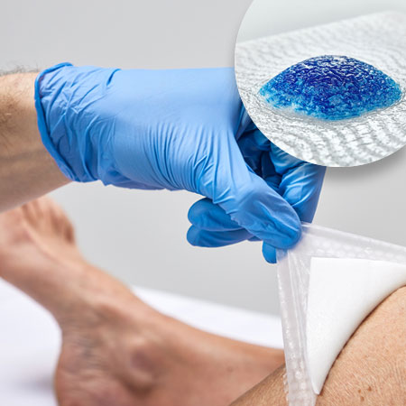 Image of a bandaged leg being treated by a person wearing blue gloves.